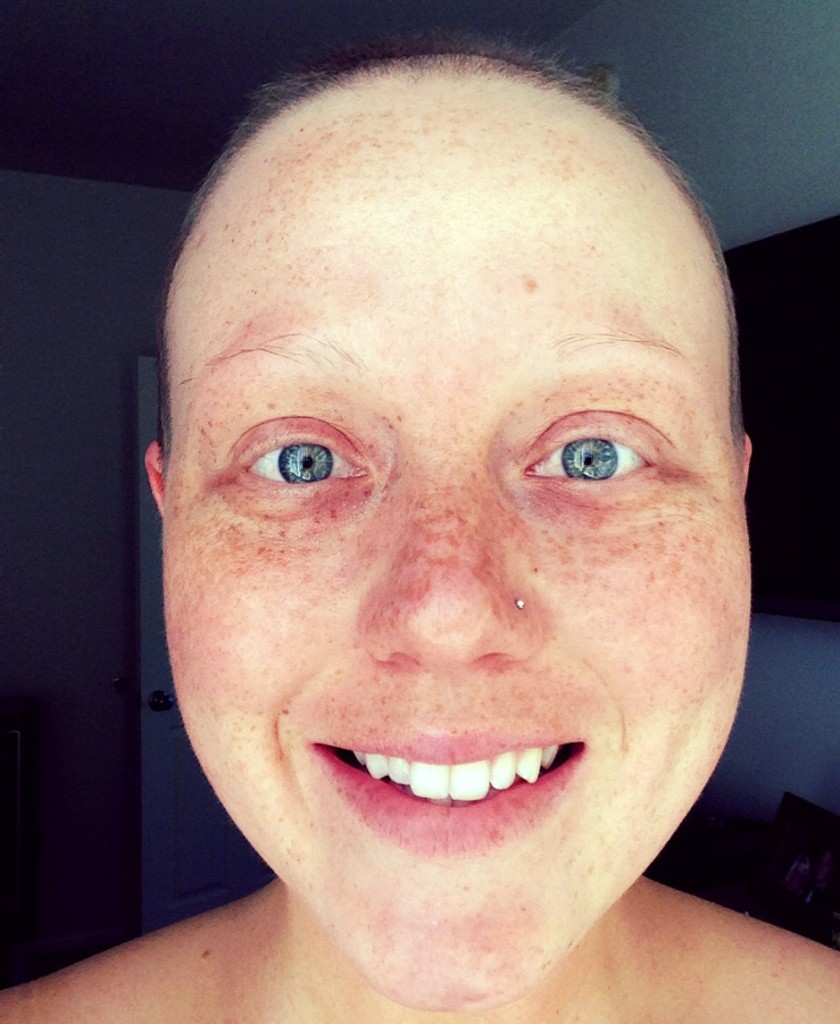 Top 91+ Pictures No Hair In The Middle Of My Head Sharp