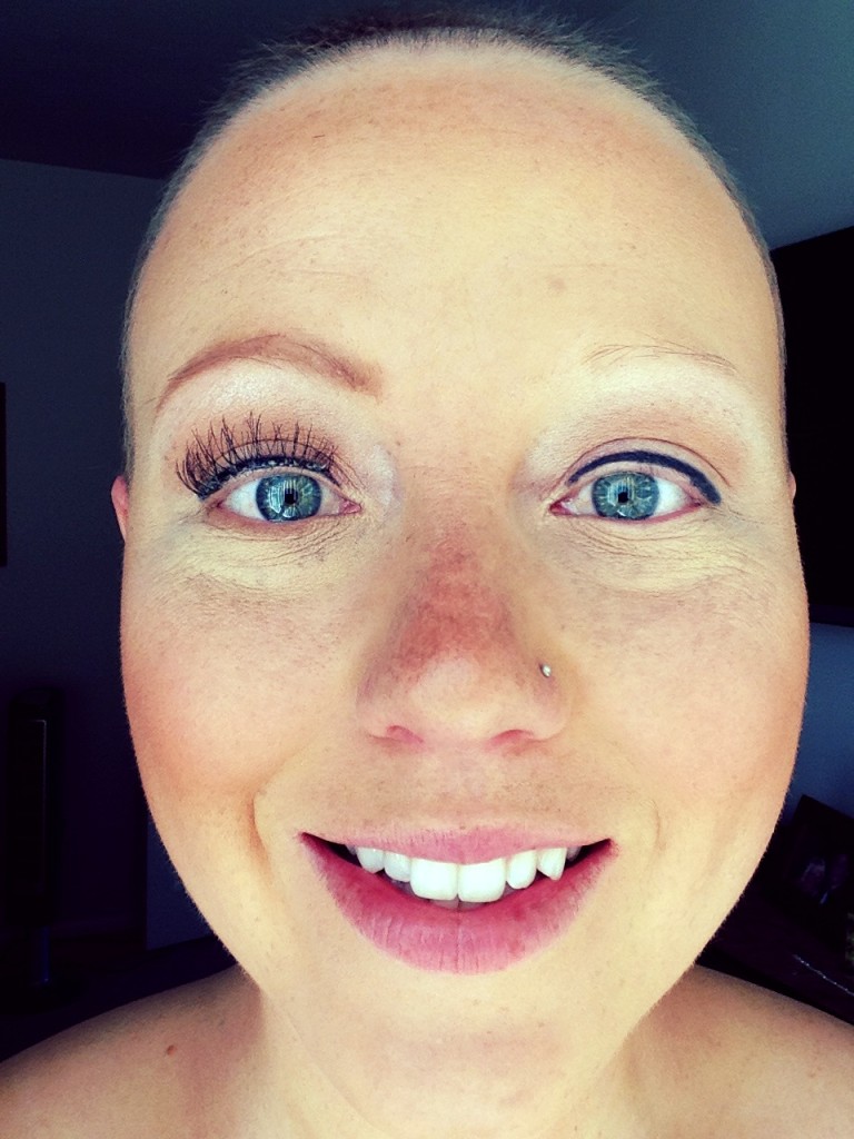 bald woman Derailing My Diagnosis